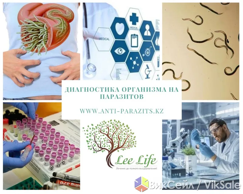 Комплексная диагностика организма на паразитов в Серебряных Прудах
