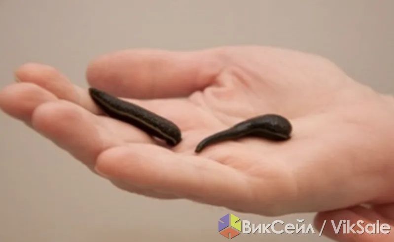 Лечение пиявками на дому: гирудотерапевт с многолетним опытом