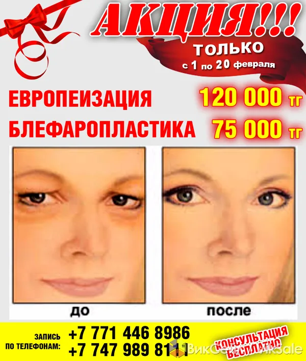 Пластические операции любой сложности в Алматы