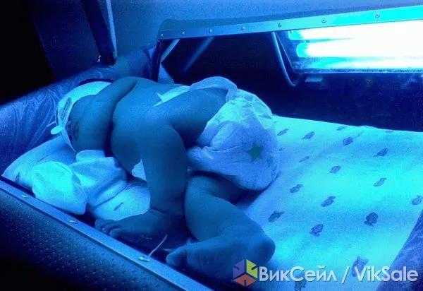 Аренда фотолампы для лечения желтушки у новорожденных